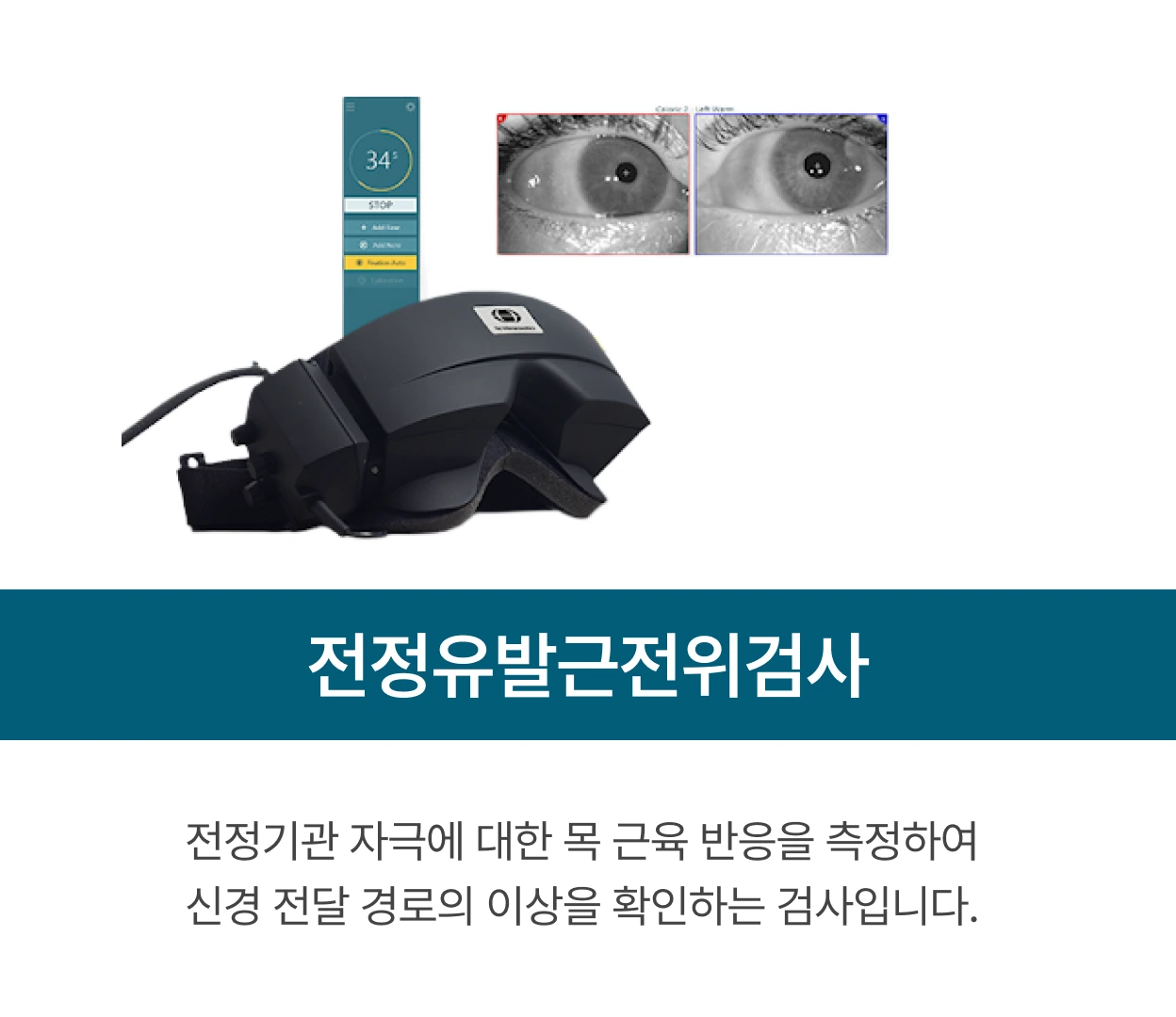 전정유발근전위검사: 전정기관 자극에 대한 목 근육 반응을 측정하여 신경 전달 경로의 이상을 확인하는 검사입니다.